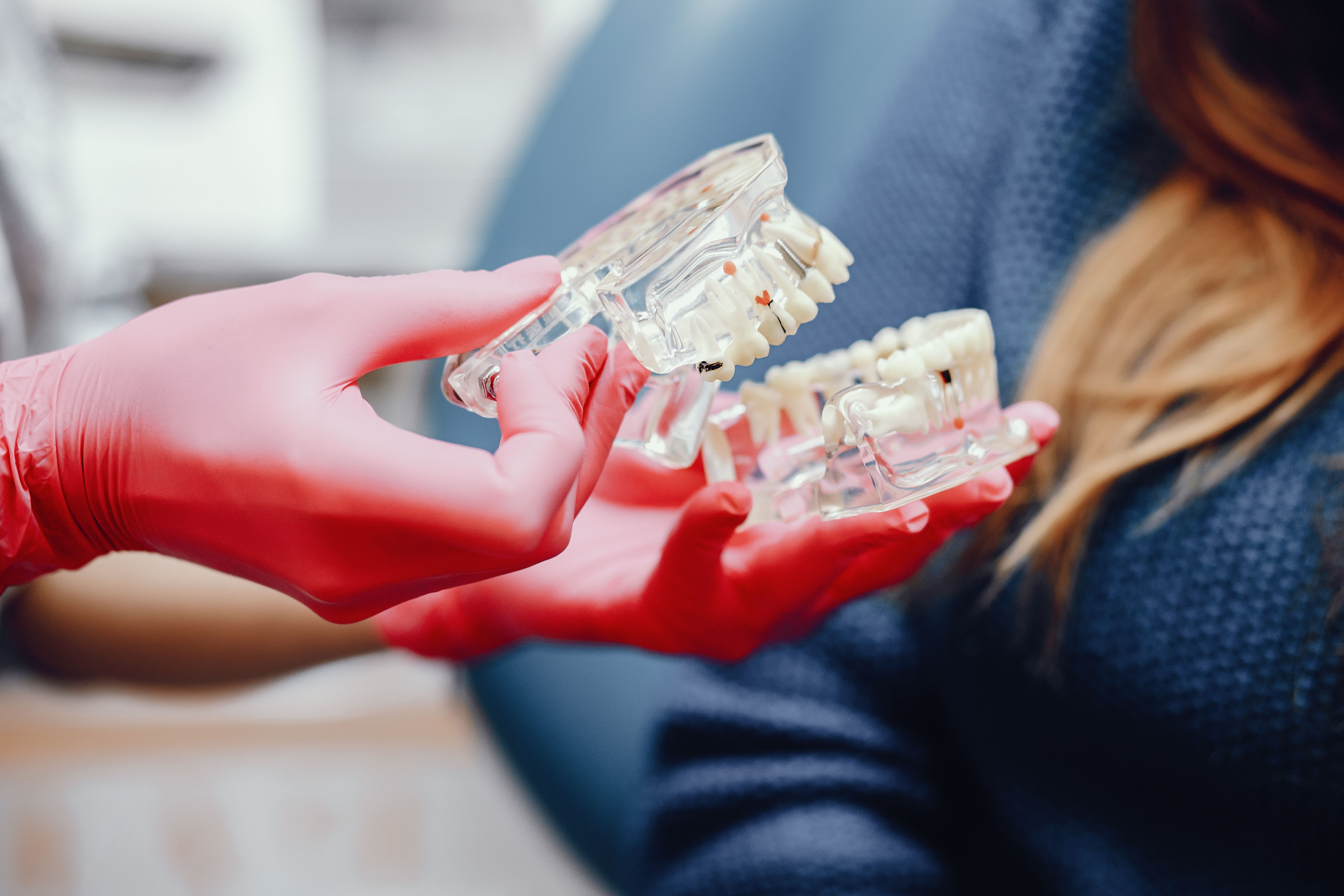 Crowns and bridges treatment at Dental Specialists Lahore