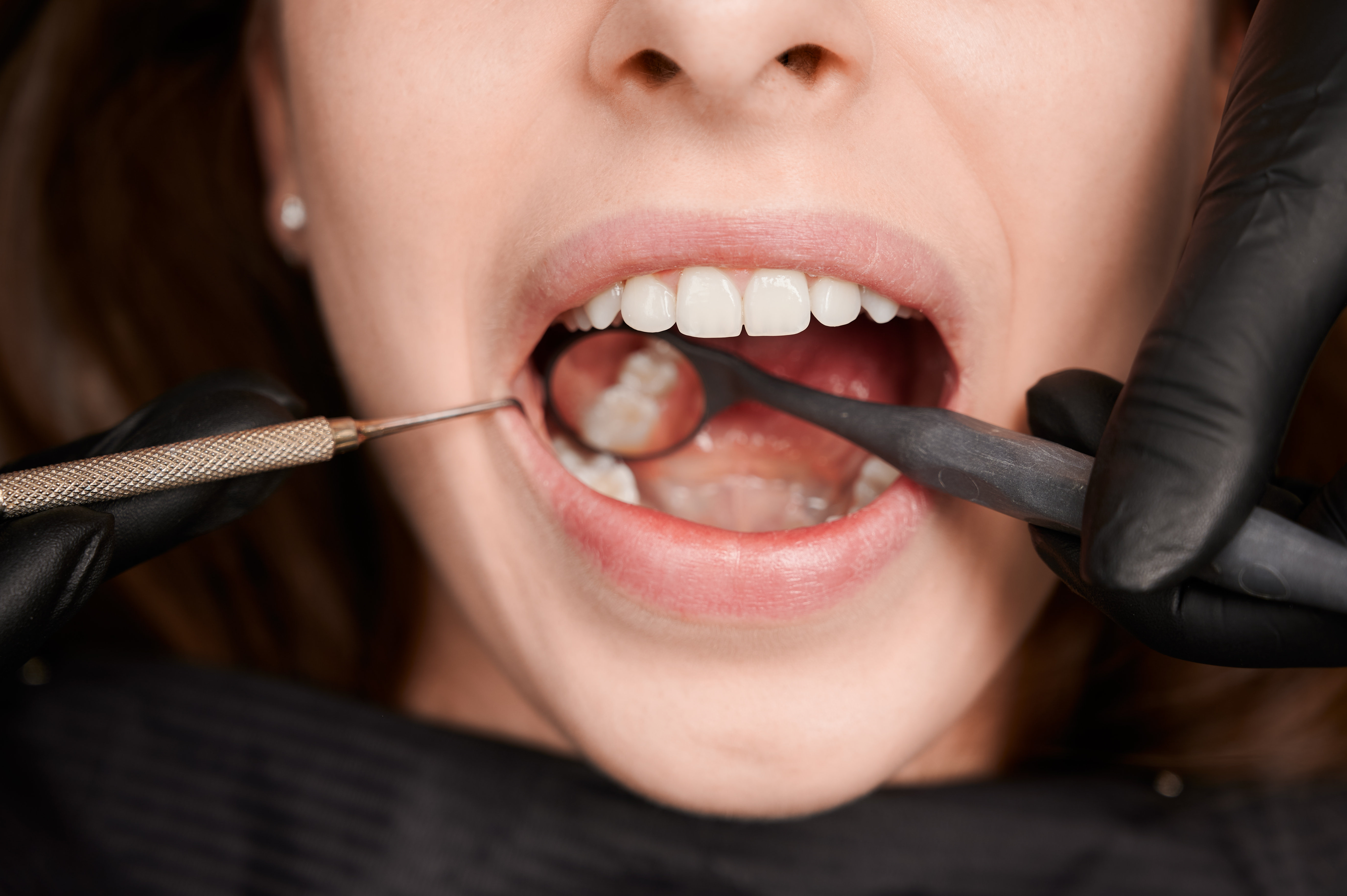 Dentist checking a new filling and bite after treatment