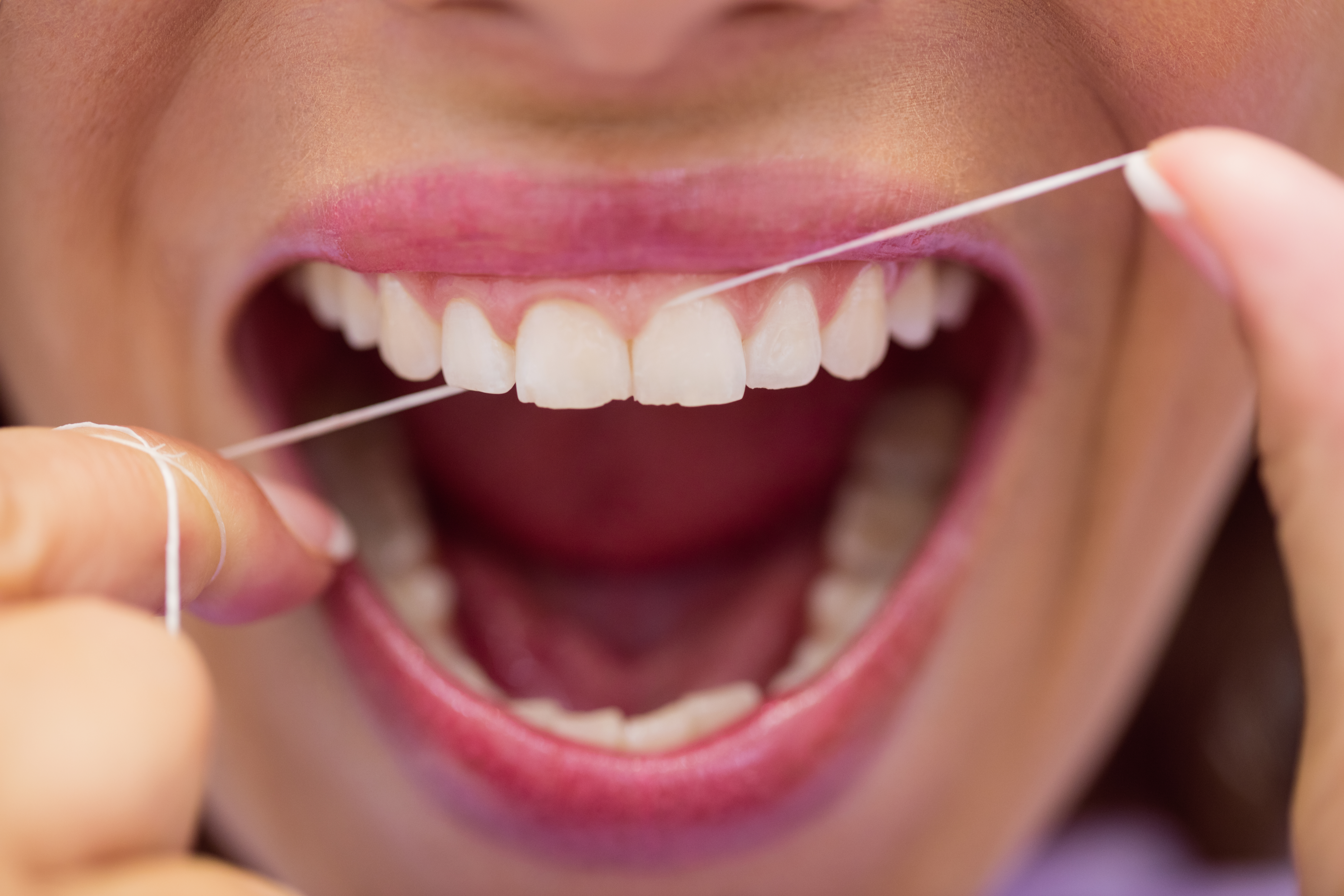 Flossing and between teeth cleaning tip from Dental Specialists Lahore