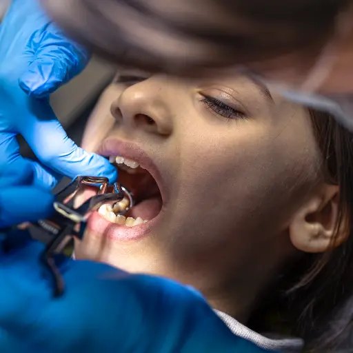 Children's dentistry and sealants at Dental Specialists Lahore