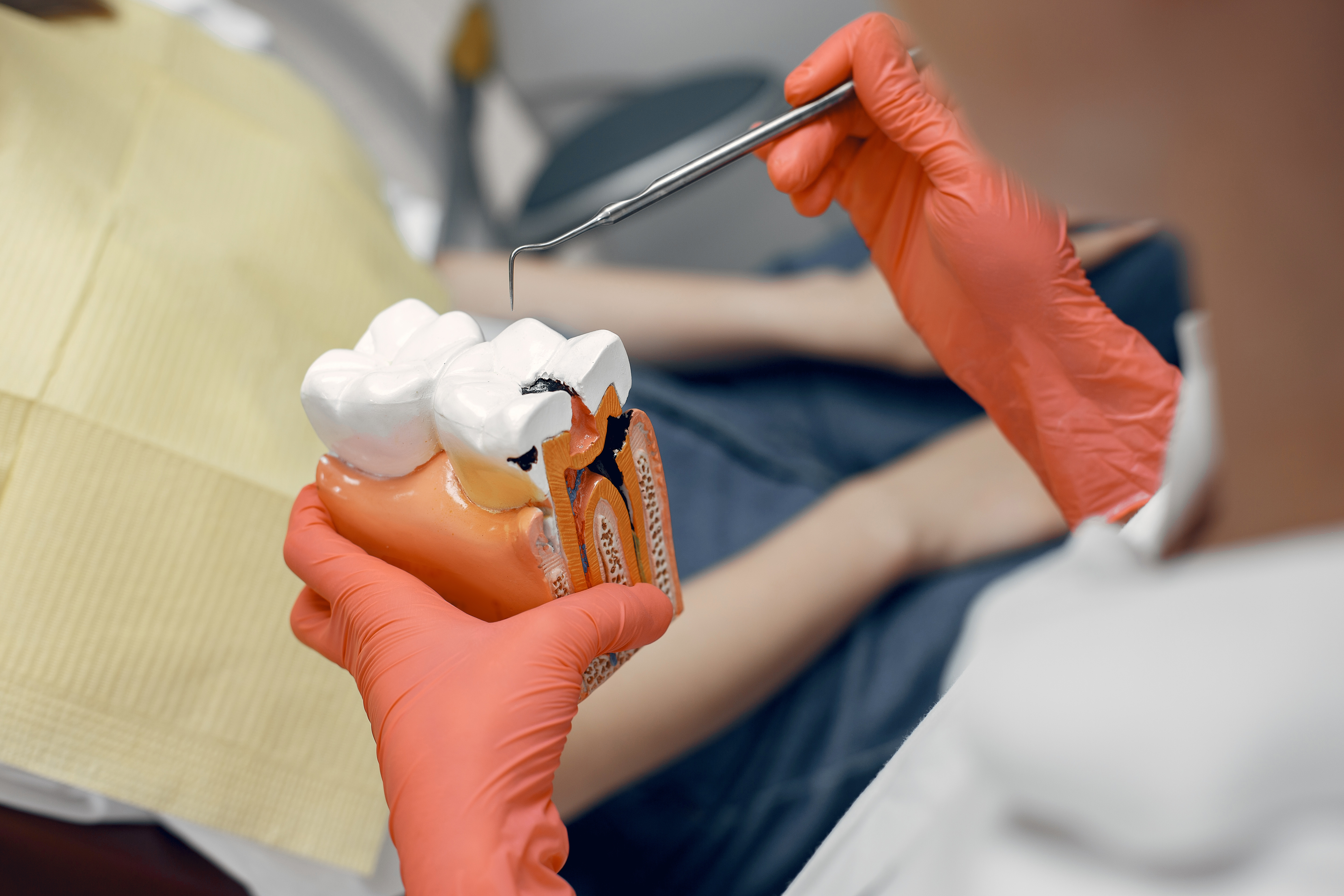 Root canal treatment at Dental Specialists Lahore