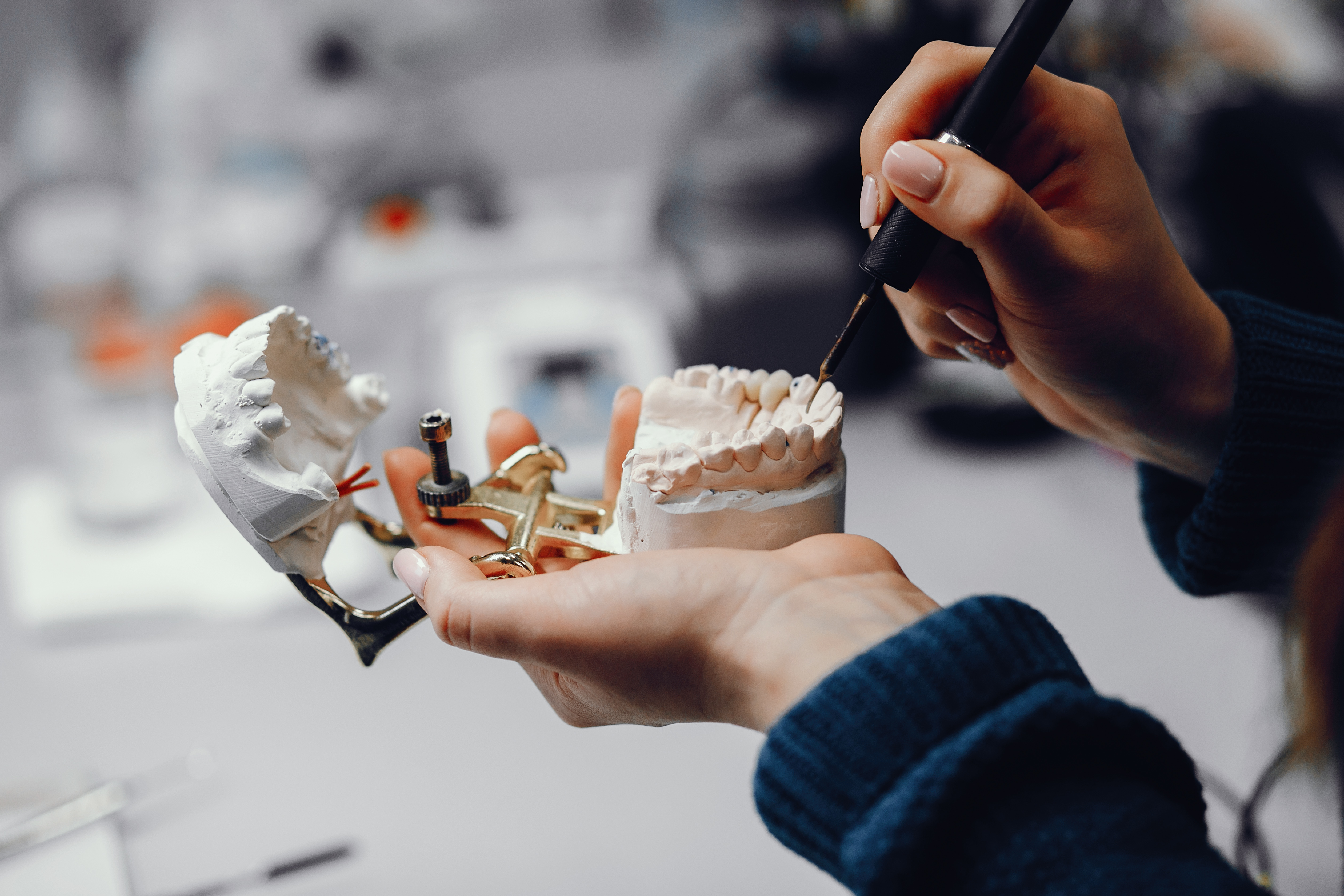 Tooth replacement treatment at Dental Specialists Lahore